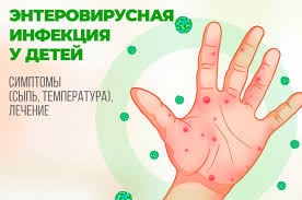 Энтеровирусные инфекции.